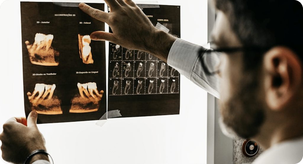 Dental professional reviewing implant X-rays for case planning