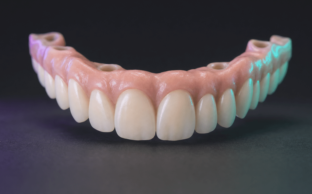 Milled PMMA full-arch provisional restoration